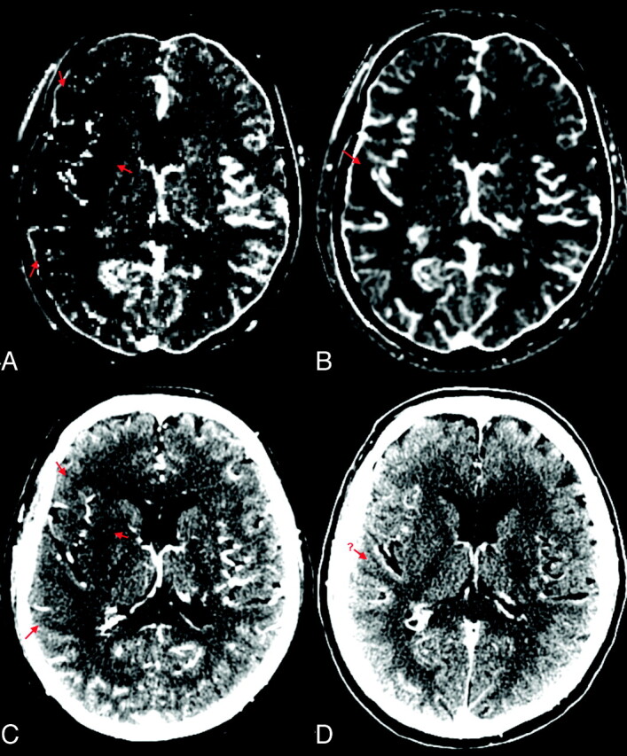 Fig 4.