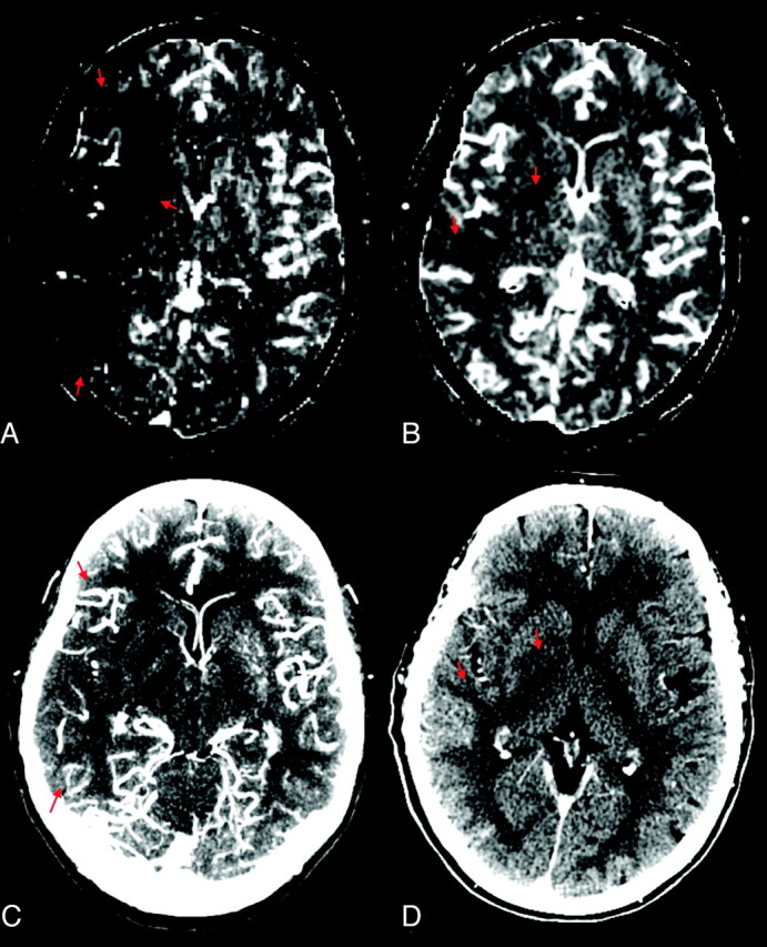 Fig 3.