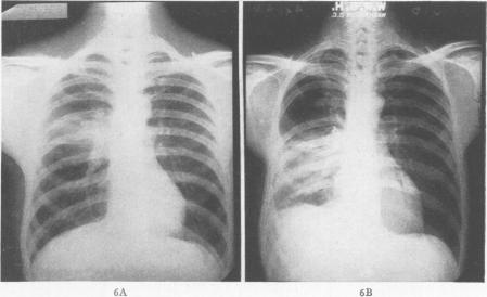 Fig. 6A., Fig. 6B.