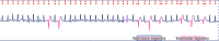 Fig. 12