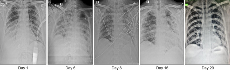 Fig. 3