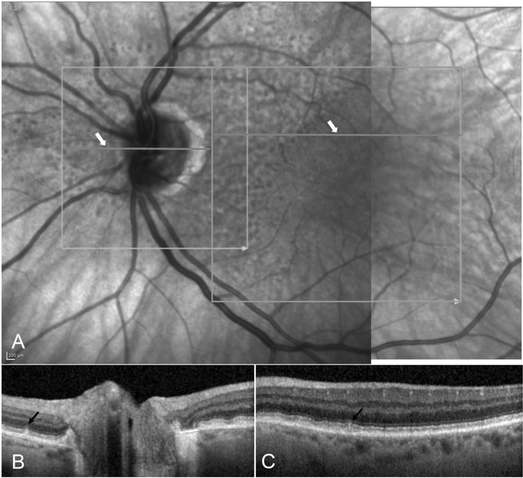 Fig. 3.