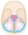 Fig 1.