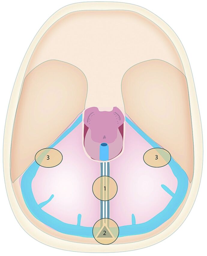 Fig 1.