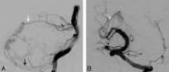 Fig 5.