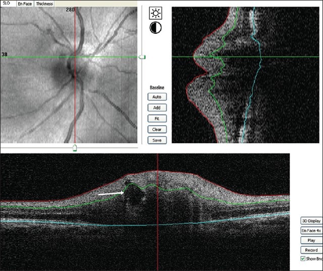 Figure 5