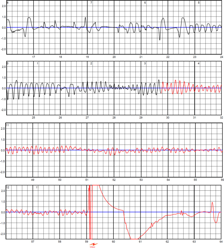 Fig. 2