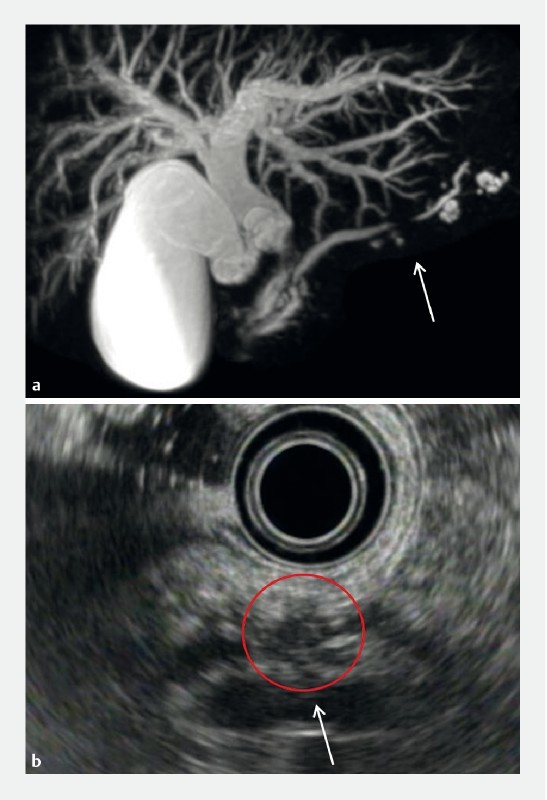 Fig. 2