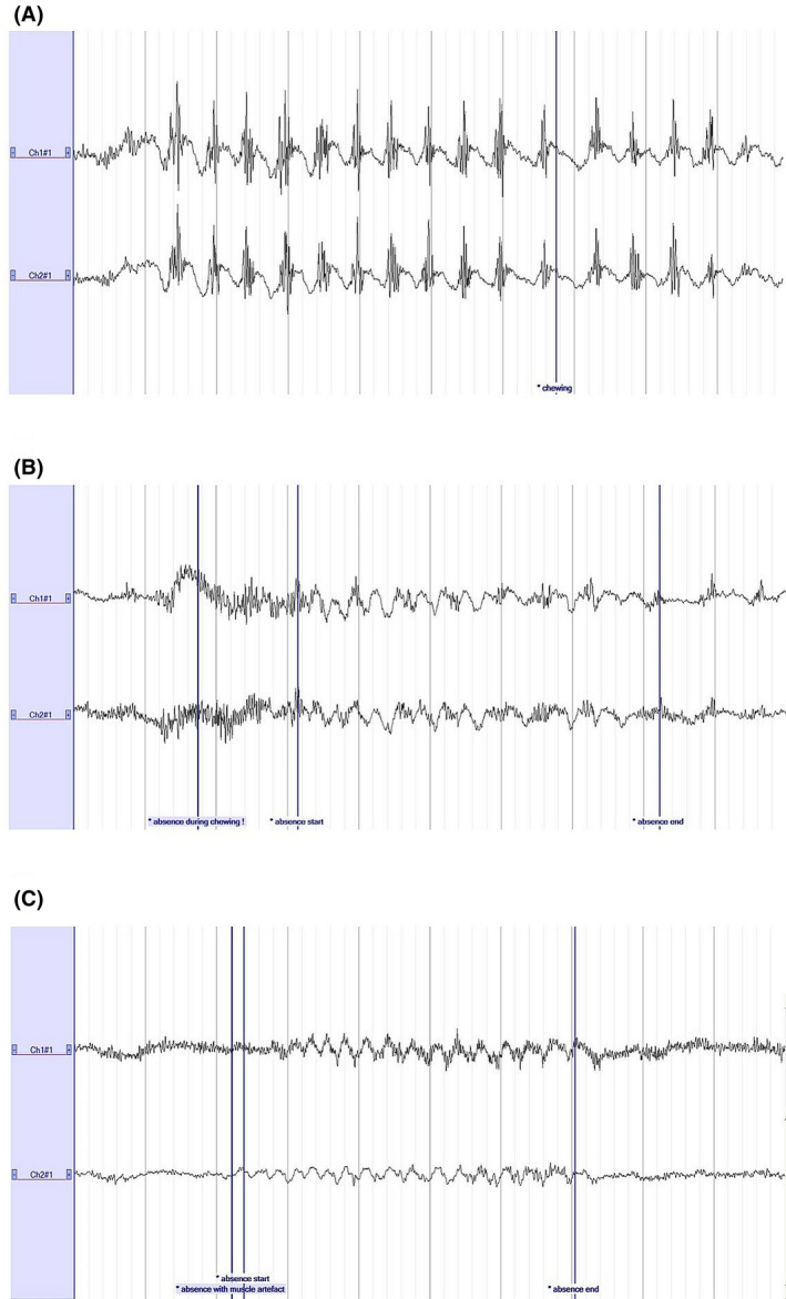 FIGURE 3