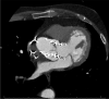 Fig. 3
