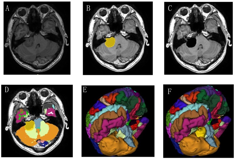 Fig 3