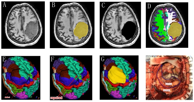 Fig 4