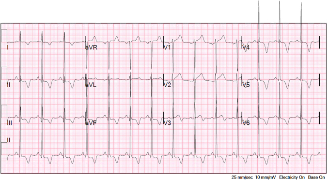 Figure 1