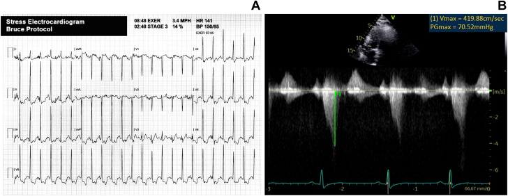 Figure 4