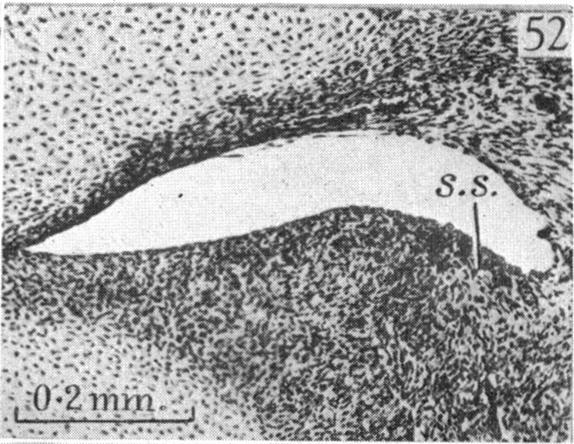 Fig. 52