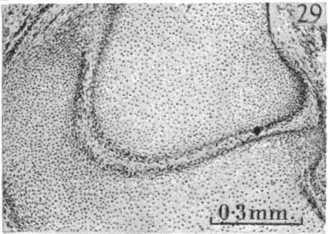 Fig. 29