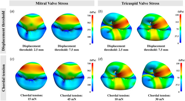 The 1st principal stress profiles at steady-state on the mitral and tricuspid valves: (a) and (b) demonstrate the differences in the stress profiles due to varying chordal displacement threshold (i.e., chordal slack length). (c) and (d) demonstrate the differences in the stress profiles due to varying chordal tension. Higher displacement threshold and lower chordal tension led to high stress on the mitral valve, but lower stress on the tricuspid valve.