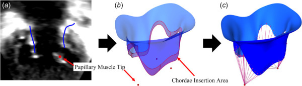 FE modeling pipeline from 3D echocardiographic image, demonstrated on tricuspid valve: chordae tendineae modeling: (a) identify papillary muscles (3D Slicer SlicerHeart), (b) define chordal insertion area, indicated here by the shaded region (SlicerHeart), and (c) project chordae (SlicerHeart)