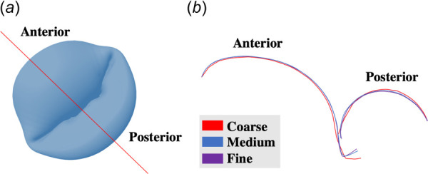 Mitral valve closing profiles: (a) location at which the slices were made (red line), and (b) valve closure configurations for coarse, medium, and fine meshes at the anterior-posterior coaptation. Nearly identical closing profiles suggested that all of the tested mesh densities were sufficient to capture valve closing behavior.