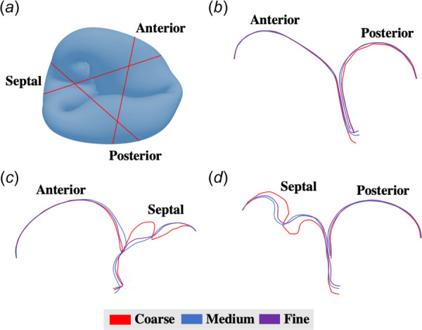 Tricuspid valve closing profiles: (a) locations at which the slices were made (red lines); valve closure configurations for coarse, medium, and fine meshes at the (b) anterior-posterior coaptation, (c) anterior-septal coaptation, and (d) posterior-septal coaptation. Septal leaflet deformation with the coarse mesh showed significantly different characteristics in comparison to the two finer meshes, suggesting that the mesh density played an important role in capturing complex curvatures, as demonstrated in the tricuspid model.