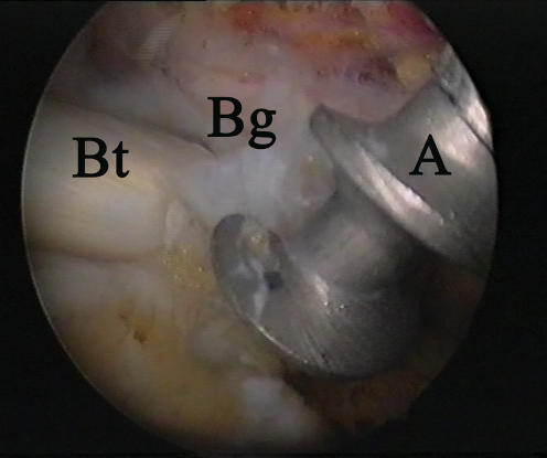 Fig. 1