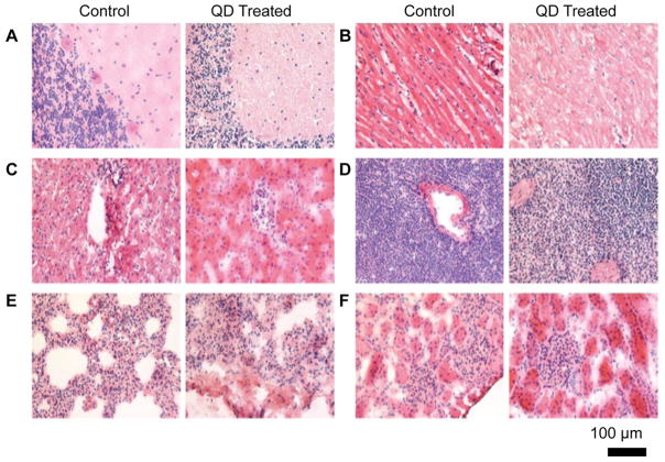 Figure 21