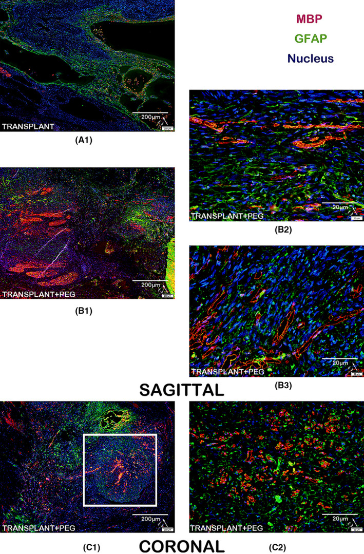 FIGURE 11