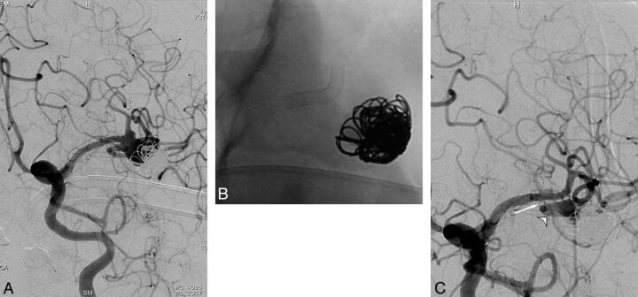 Fig 3.