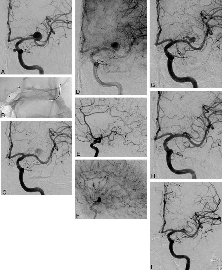 Fig 2.