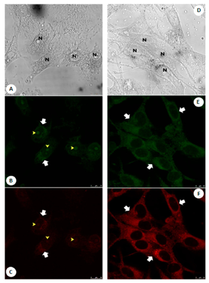 Figure 22