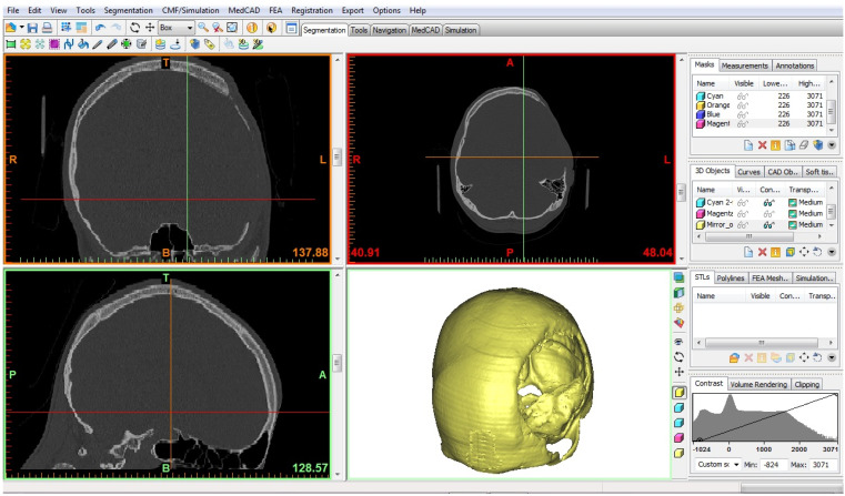 Figure 1