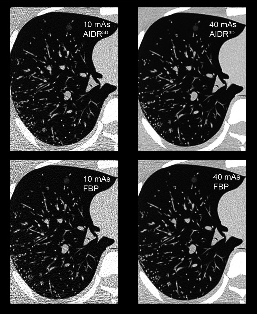 FIG. 1.