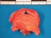 Figure 3)