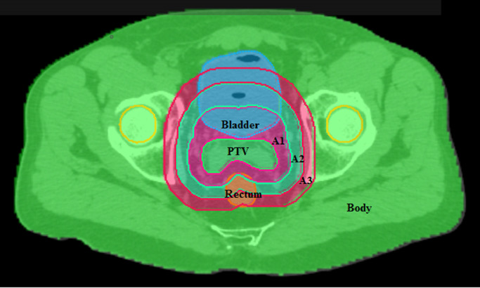 Fig. 1