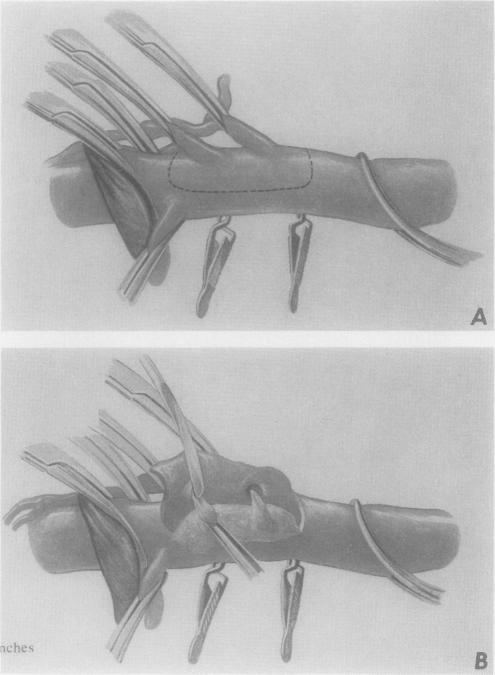 Fig. 3A and B.