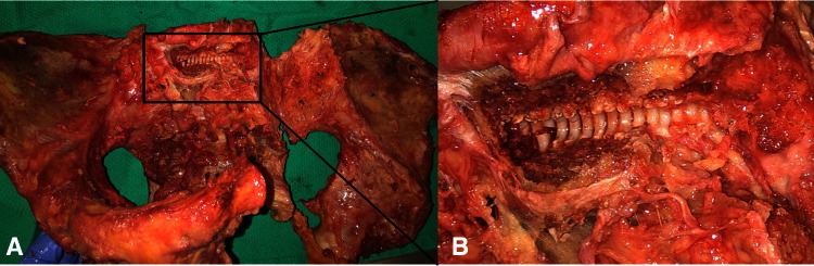 Fig. 1A–B