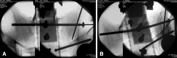 Fig. 7A–B