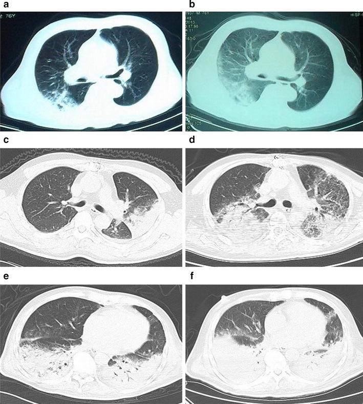 Fig. 2