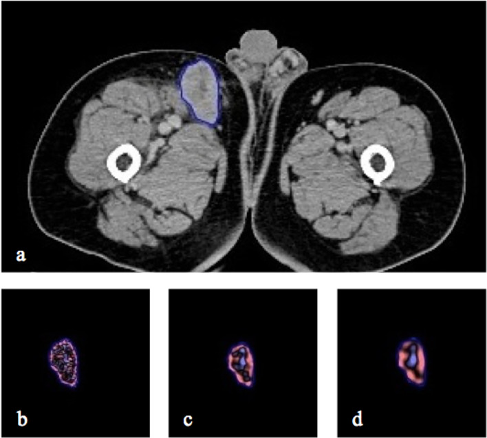 Figure 2