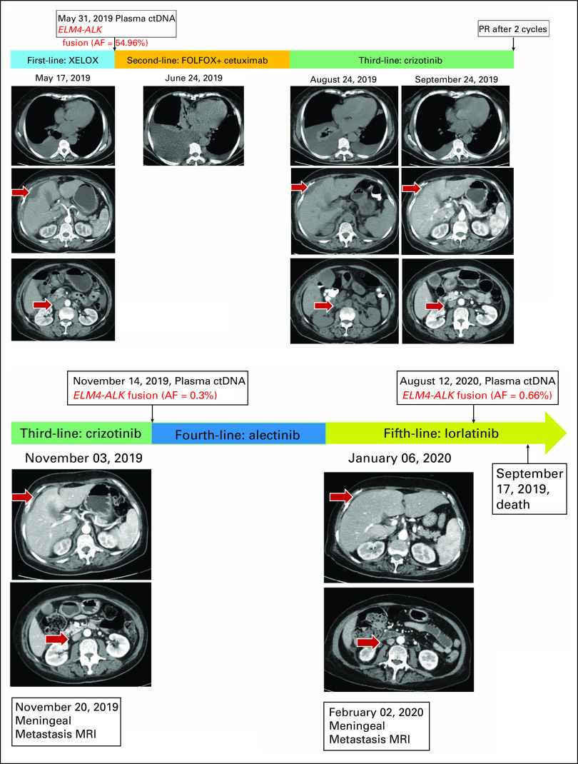 FIG 4.