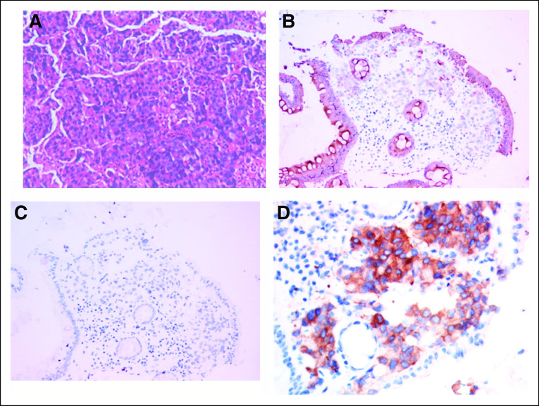 FIG 2.