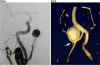 Fig. (2)