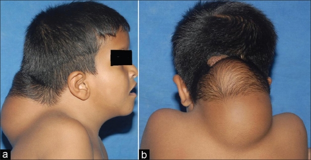 Figure 1 (a,b)