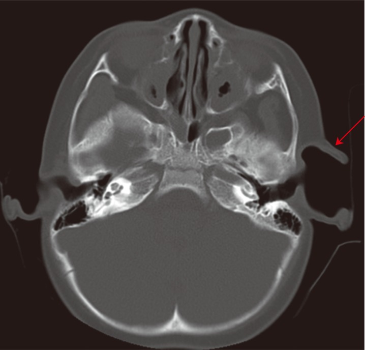 Fig. 2