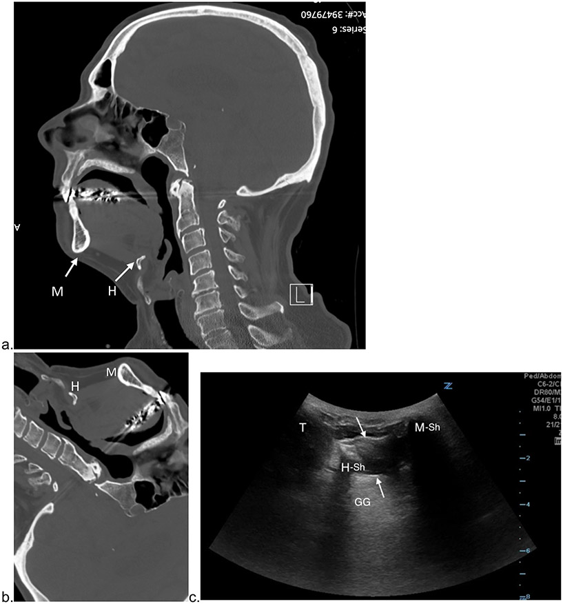 Figure 2: