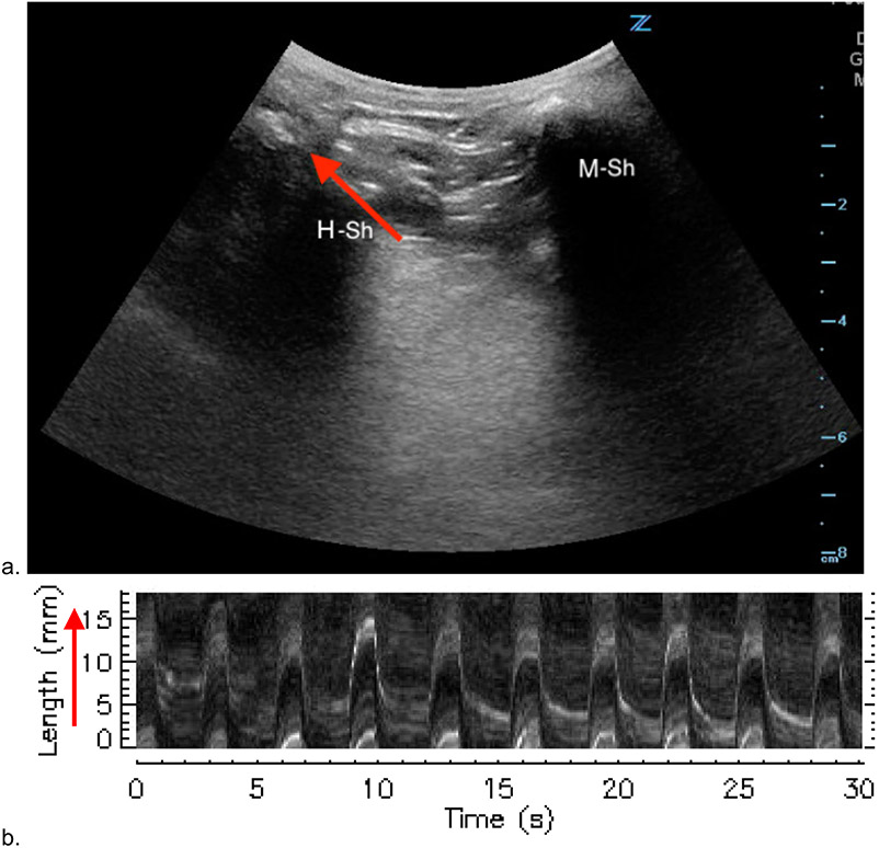 Figure 3: