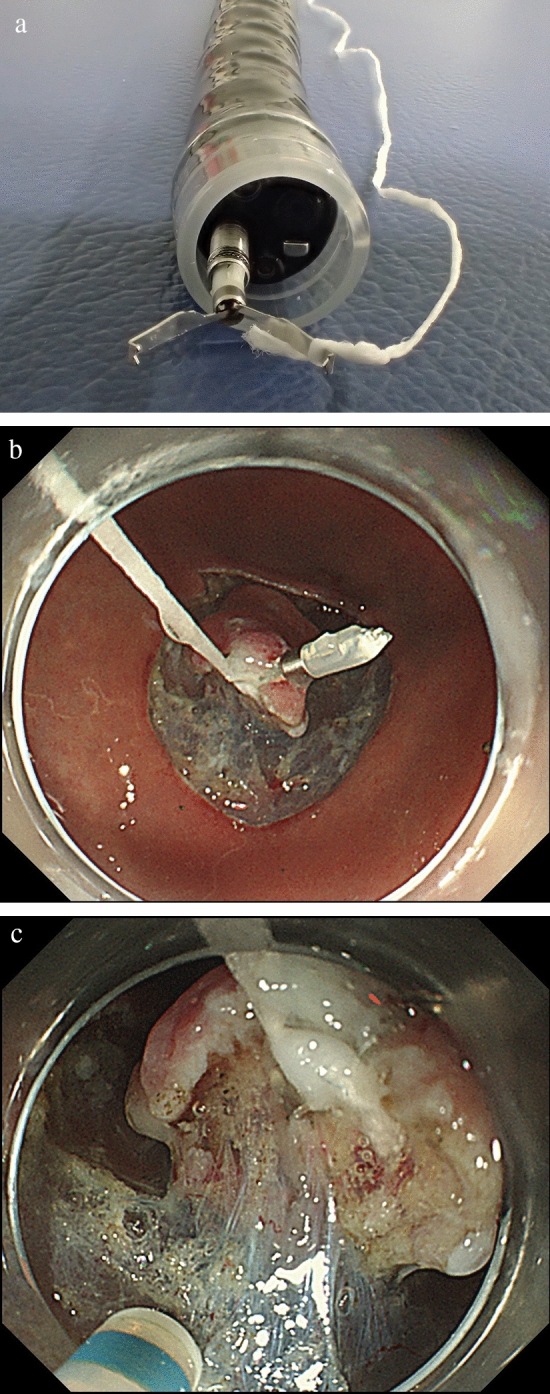 Fig. 5