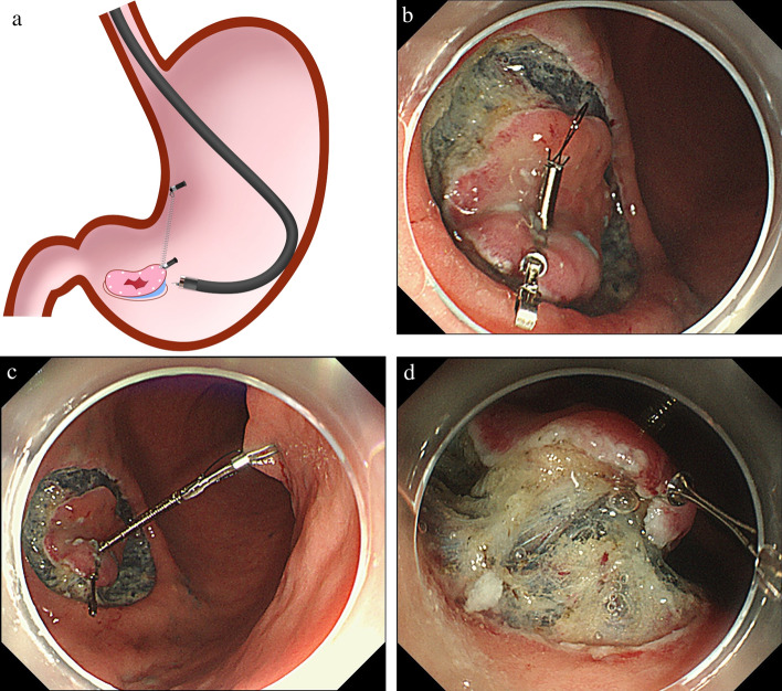 Fig. 6