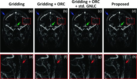 FIG. 4.