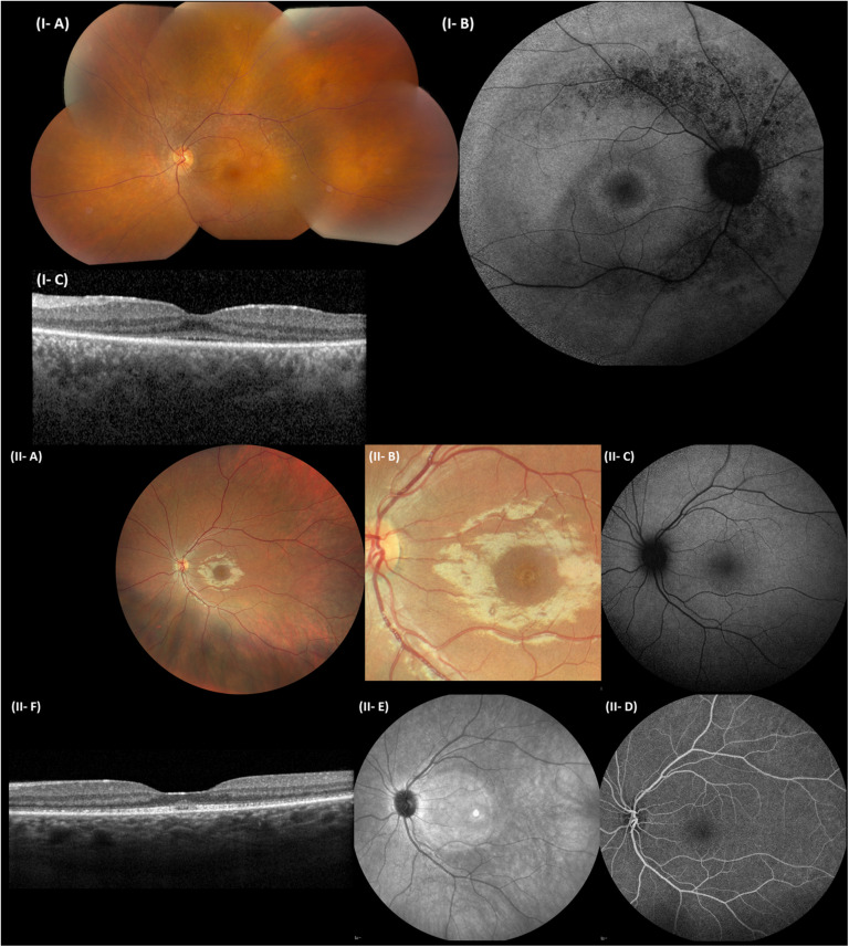 FIGURE 4